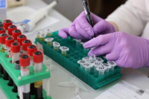 how often should you get cholesterol checked