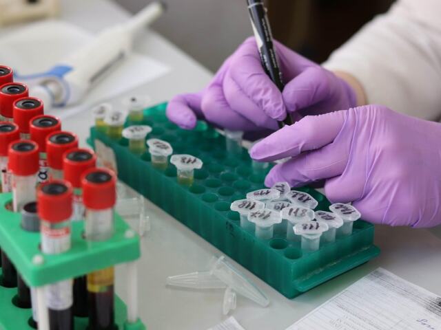 Cholesterol Screening Guidelines
